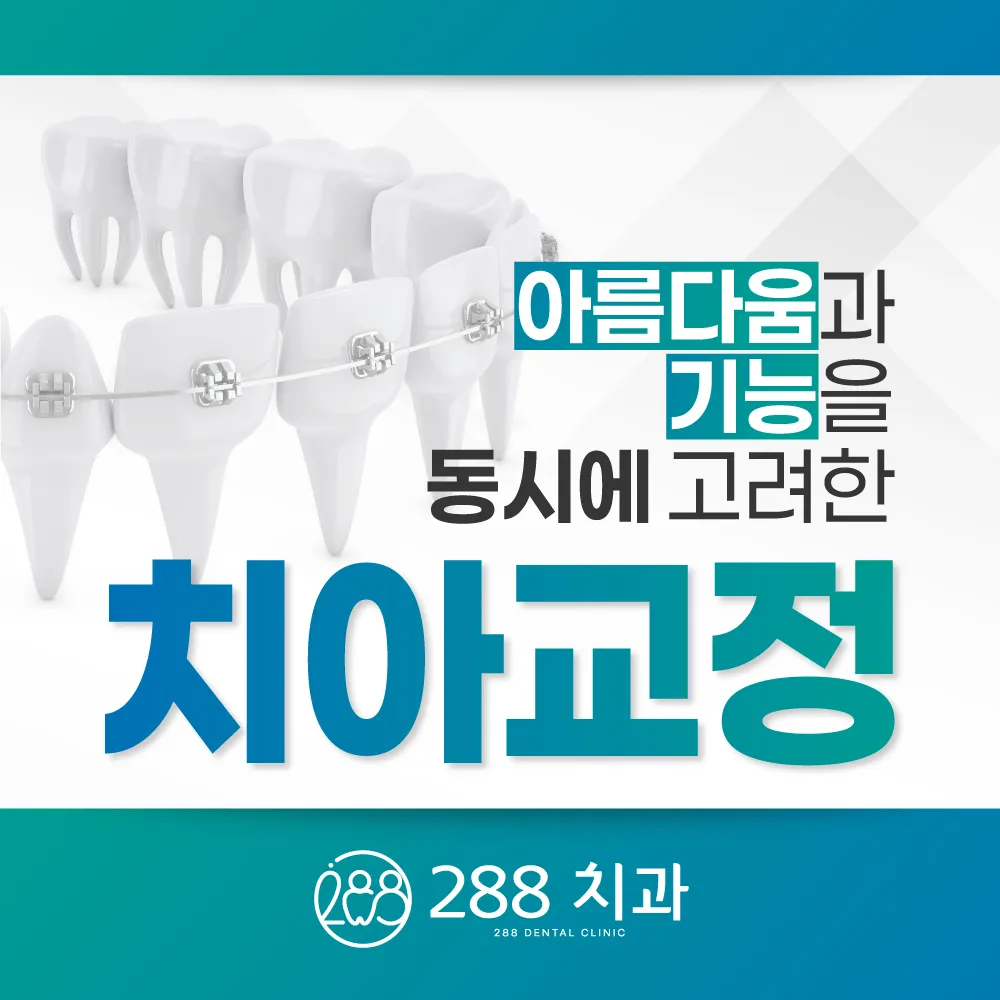 아름다움과 기능을 동시에 고려한 치아교정 — 288치과