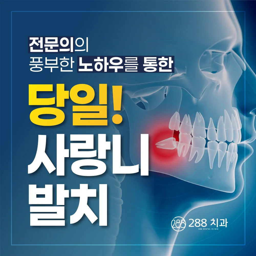 전문의의 풍부한 노하우를 통한 당일 사랑니 발치 — 288치과